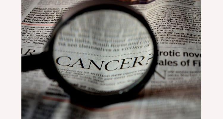 Doctors warn against delayed diagnosis as prostate cancer cases rise